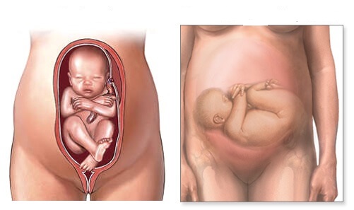 Abnormal Presentations in Pregnancy