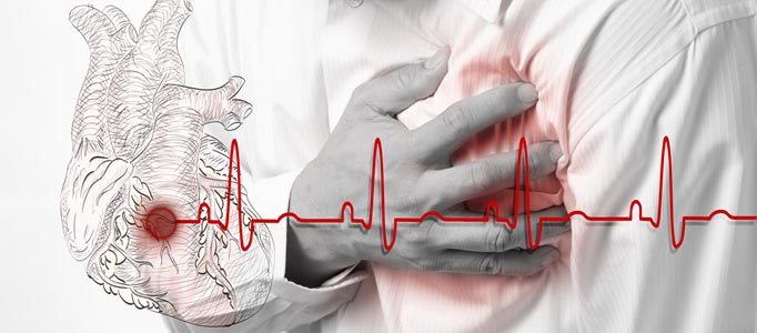 Chest Pain and CAD for GPs