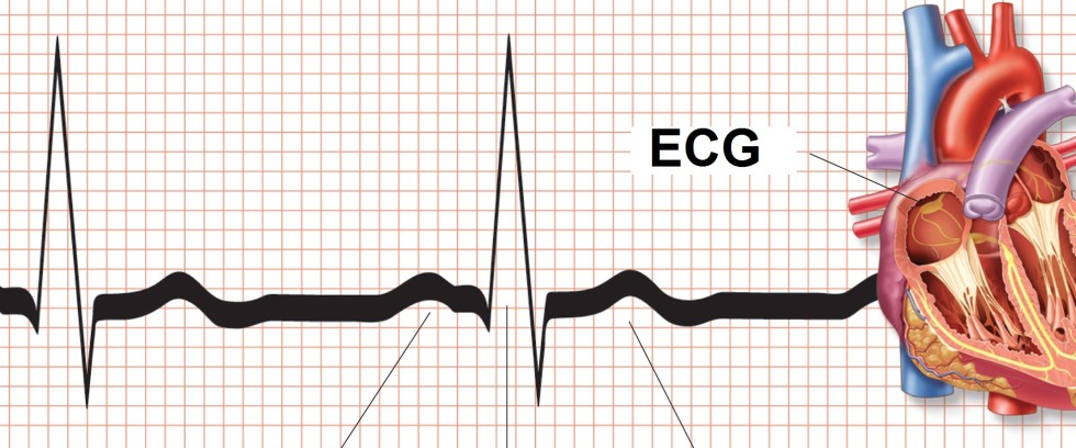 Electrocardiogram for GPs