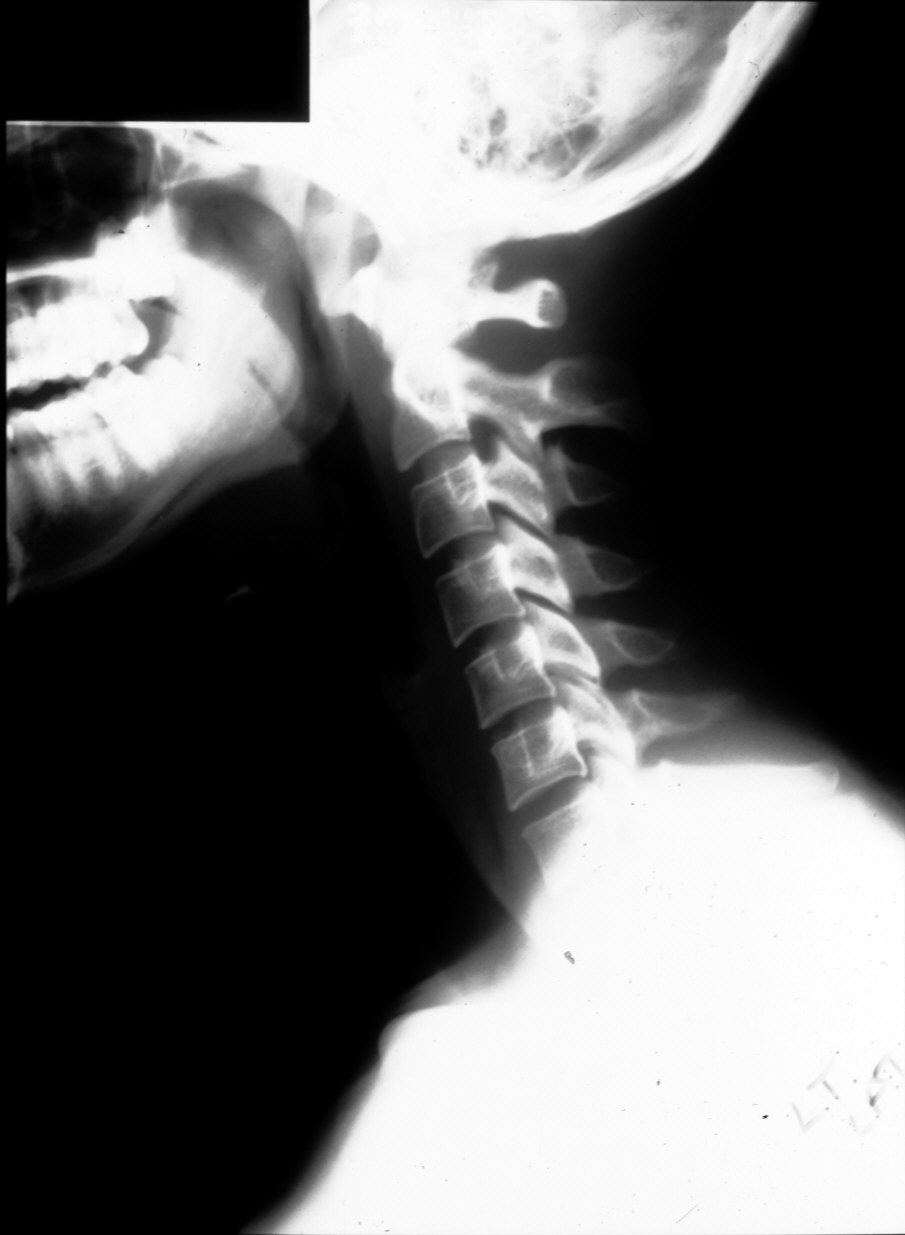 Radiology of head and neck